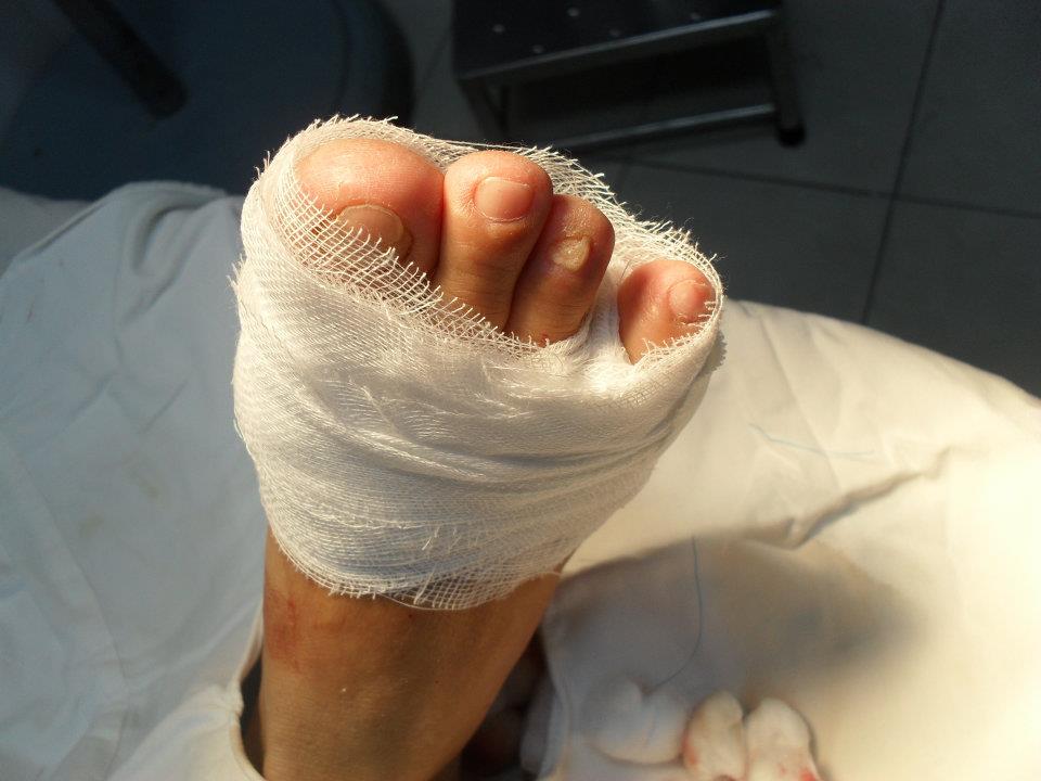 Chuẩn bị theo quy trình thay băng vết mổ của Bộ y tế