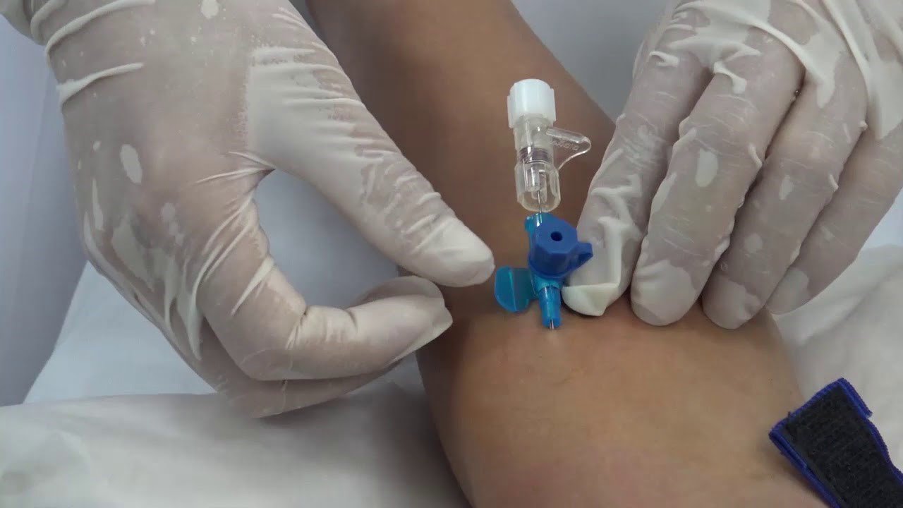 bác sĩ thực hiện vô nước biển