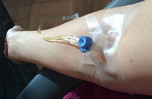 vô nước biển tại nhà